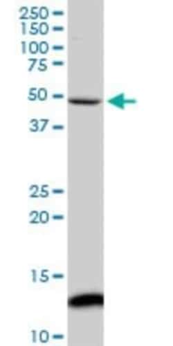 Iroquois-class homeodomain protein IRX-5 Antibody (8A12), Novus Biologicals