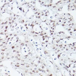 Islet-1 Rabbit anti-Human, Mouse, Rat, Clone: 1G9Q8, Novus Biologicals:Antibodies:Primary