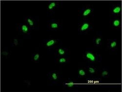 Islet-1 Antibody (2E7), Novus Biologicals 0.1 mg, Unconjugated:Antibodies,
