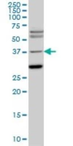 Islet-1 Antibody (2E7), Novus Biologicals 0.1 mg, Unconjugated:Antibodies,