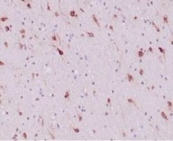 Isocitrate Dehydrogenase 1/IDH1 Rabbit anti-Human, Clone: IDH1/6806R, Novus