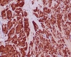 Isocitrate Dehydrogenase 1/IDH1 Rabbit anti-Human, Clone: IDH1/6806R, Novus