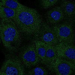 Isocitrate Dehydrogenase 1/IDH1 Antibody (CL0219), Novus Biologicals:Antibodies:Primary