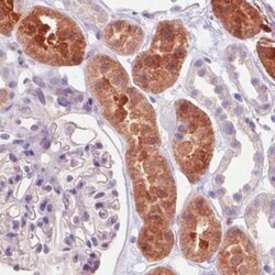 Isocitrate Dehydrogenase 1/IDH1 Antibody (CL0219), Novus Biologicals 25