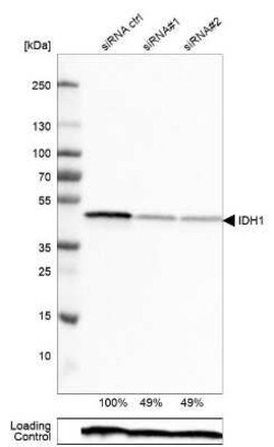 Isocitrate Dehydrogenase 1/IDH1 Antibody (CL0219), Novus Biologicals 25
