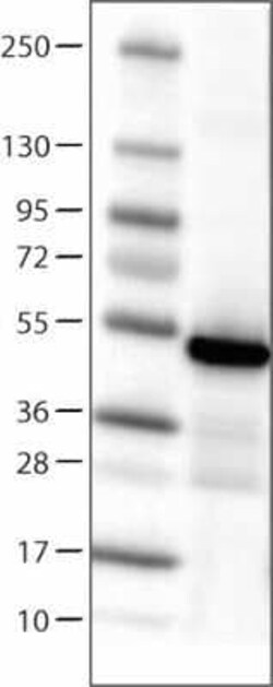 Isocitrate Dehydrogenase 1/IDH1 Antibody (CL0219), Novus Biologicals 25