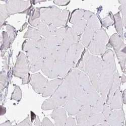 Isocitrate Dehydrogenase 1/IDH1 Antibody, Novus Biologicals 25 &mu;L; Unconjugated:Antikörper