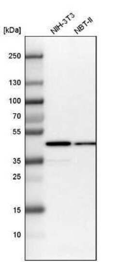 Isocitrate Dehydrogenase 1/IDH1 Antibody, Novus Biologicals 25 &mu;L; Unconjugated:Antikörper
