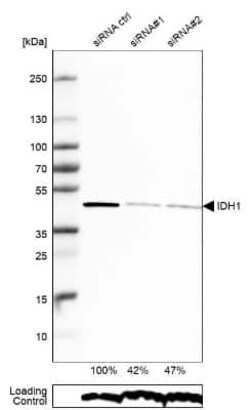 Isocitrate Dehydrogenase 1/IDH1 Antibody, Novus Biologicals 25 &mu;L; Unconjugated:Antikörper
