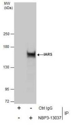 Isoleucyl tRNA synthetase Antibody, Novus Biologicals 100 &mu;g | Buy Online | Novus Biologicals | Fisher Scientific