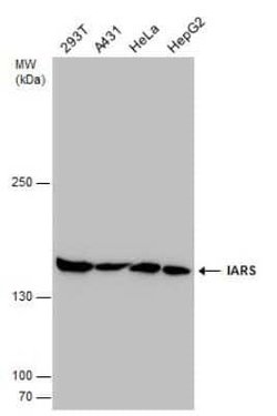 Isoleucyl tRNA synthetase Antibody, Novus Biologicals 100 &mu;g | Buy Online | Novus Biologicals | Fisher Scientific