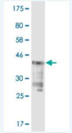 Isopeptidase T/USP5 Antibody (4G4), Novus Biologicals 0.1 mg | Buy Online | Novus Biologicals | Fisher Scientific