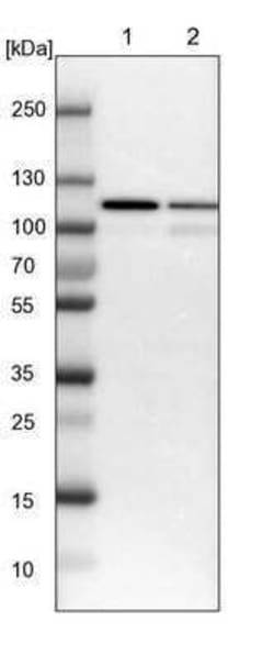 Isopeptidase T/USP5 Antibody, Novus Biologicals 0.1 mL; Unconjugated:Antibodies,