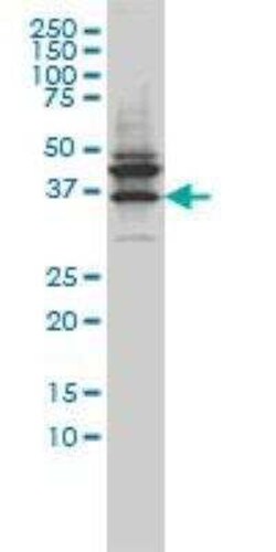 JAM-B/VE-JAM Antibody (1G4), Novus Biologicals 0.1 mg | Buy Online | Novus Biologicals | Fisher Scientific