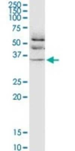 JAM-B/VE-JAM Antibody (1G4), Novus Biologicals 0.1 mg | Buy Online | Novus Biologicals | Fisher Scientific