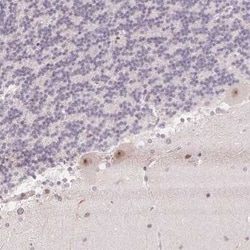 JMJD2D Antibody, Novus Biologicals:Antibodies:Primary Antibodies