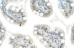 JMJD2D Antibody, Novus Biologicals 100 &mu;L; Unconjugated:Antibodies,
