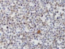 JMJD4 Antibody (JMJD4/32b/H12) - BSA Free, Novus Biologicals 0.025 mL | Buy Online | Novus Biologicals | Fisher Scientific