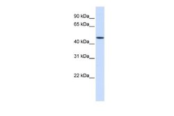 JMJD5 Rabbit anti-Human, Polyclonal, Novus Biologicals 0.1 mL | Buy Online | Novus Biologicals | Fisher Scientific