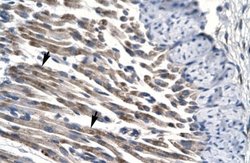 JMJD8 Antibody, Novus Biologicals 100 &mu;L; Unconjugated:Antibodies, Polyclonal