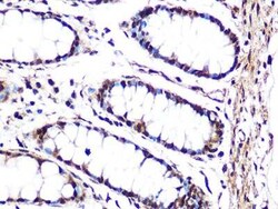 JNK1 Rabbit anti-Human, Mouse, Rat, Clone: 8Q7S4, Novus Biologicals 100 &mu;g | Buy Online | Novus Biologicals | Fisher Scientific