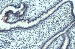 JNK1, p Thr183, p Tyr185 Antibody (HL1008), Novus Biologicals 100 &mu;g;