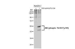 JNK1, p Thr183, p Tyr185 Antibody (HL1008), Novus Biologicals 100 &mu;g;