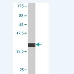 JNK3 Antibody (2B2), Novus Biologicals 0.1 mg | Buy Online | Novus Biologicals | Fisher Scientific
