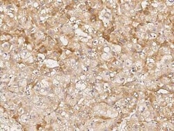 Jade-1/PHF17 Antibody, Novus Biologicals 100 &mu;g | Buy Online | Novus Biologicals | Fisher Scientific