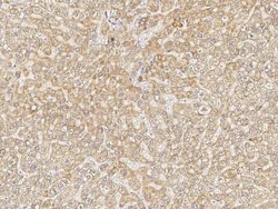 Jade-1/PHF17 Antibody, Novus Biologicals 100 &mu;g | Buy Online | Novus Biologicals | Fisher Scientific