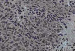 Jagged 1 Antibody, Novus Biologicals Jagged 1 Antibody; Unconjugated; 0.25