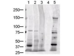 Jagged 1 Antibody, Novus Biologicals Jagged 1 Antibody; Unconjugated; 0.25