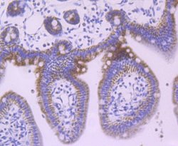 Jak1 Rabbit anti-Human, Mouse, Rat, Clone: JM75-03, Novus Biologicals 100