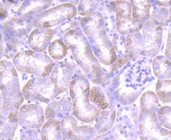 Jak1 Rabbit anti-Human, Mouse, Rat, Clone: JM75-03, Novus Biologicals 100