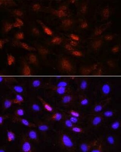Jak1, p Tyr1022, p Tyr1023 Antibody - BSA Free, Novus Biologicals 100 &mu;g;