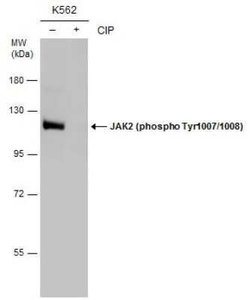 Jak2, p Tyr1007, p Tyr1008 Antibody, Novus Biologicals 100 &mu;g | Buy Online | Novus Biologicals | Fisher Scientific