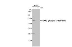 Jak2, p Tyr1007, p Tyr1008 Antibody, Novus Biologicals 100 &mu;g | Buy Online | Novus Biologicals | Fisher Scientific
