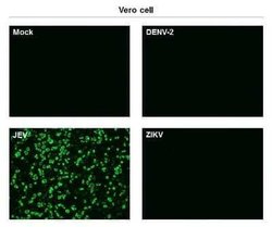 Japanese Encephalitis virus NS1 Antibody (GT1410), Novus Biologicals 100 &mu;g | Buy Online | Novus Biologicals | Fisher Scientific