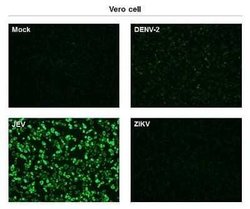 Japanese Encephalitis virus NS1 Antibody (GT481), Novus Biologicals 100 &mu;g | Buy Online | Bio-Techne | Fisher Scientific
