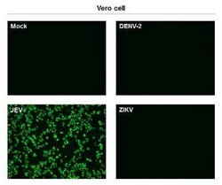 Japanese Encephalitis virus NS1' Antibody (GT25111), Novus Biologicals 100 &mu;g | Buy Online | Novus Biologicals | Fisher Scientific