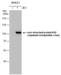 Japanese Encephalitis virus NS5 Antibody, Novus Biologicals 100 &mu;g | Buy Online | Novus Biologicals | Fisher Scientific