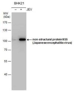 Japanese Encephalitis virus NS5 Antibody, Novus Biologicals 100 &mu;g | Buy Online | Novus Biologicals | Fisher Scientific