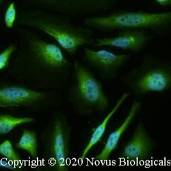Jumonji/JARID2 Antibody - BSA Free, Novus Biologicals:Antibodies:Primary