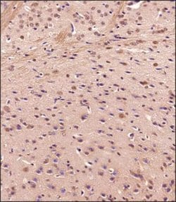 Jumonji/JARID2 Antibody - BSA Free, Novus Biologicals:Antibodies:Primary