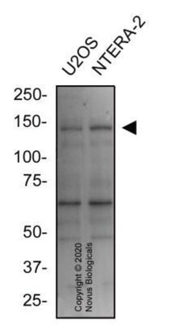 Jumonji/JARID2 Antibody - BSA Free, Novus Biologicals:Antibodies:Primary