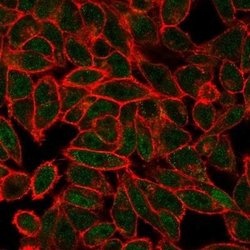 JunB/AP-1 Mouse anti-Human, Clone: PCRP-JUNB-3G2, Novus Biologicals 20