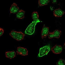 KA2/GRIK5/Glutamate Receptor KA2 Antibody, Novus Biologicals:Antibodies:Primary