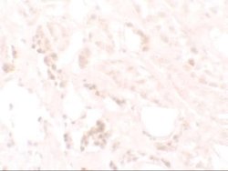 KANK3 Antibody - BSA Free, Novus Biologicals 0.1 mg | Buy Online | Novus Biologicals | Fisher Scientific