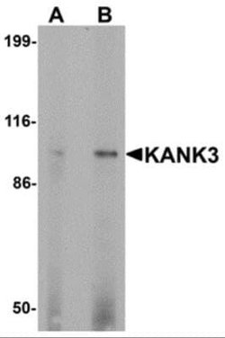 KANK3 Antibody - BSA Free, Novus Biologicals 0.1 mg | Buy Online | Novus Biologicals | Fisher Scientific