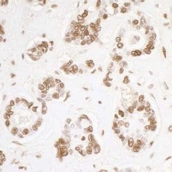 KAP1 Antibody (BL-248-2G6), Novus Biologicals 100 &mu;L; Unconjugated:Antibodies,